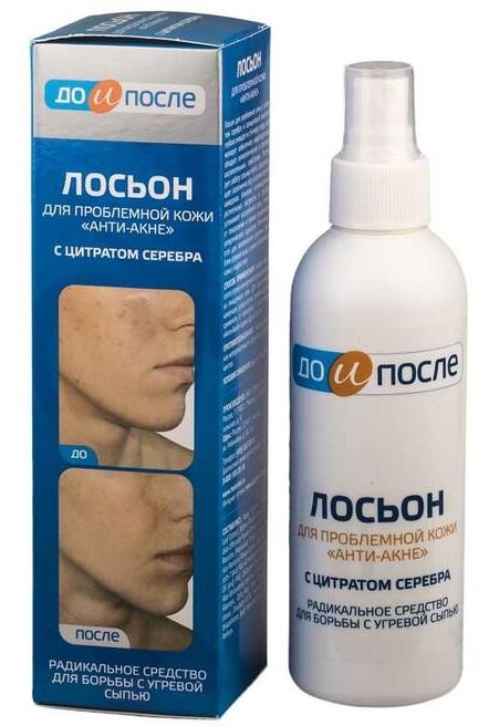 ДО И ПОСЛЕ Лосьон Анти-Акне 200мл д/пробл.кожи (Р)