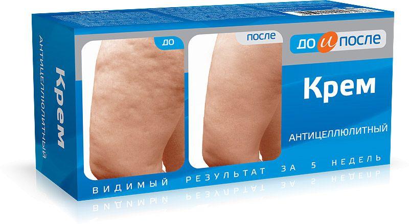 ДО И ПОСЛЕ Крем антицеллюлитный 100мл (Р)